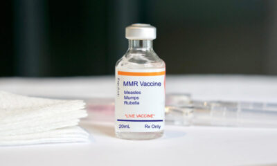 San Diego measles case 2025